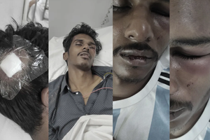 ނަޒީފަށް ހަމަލާދިން މައްސަލައިގައި އިތުރު މީހަކު ހައްޔަރުކޮށްފި
